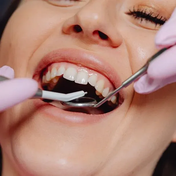 Ispezione orale di una donna prima di un trattamento di Sbiancamento denti Genova - Dott.ssa Camilla Colella